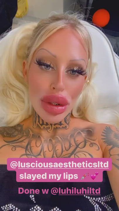 Holy fucking s**t Alicia Amira's new lips are HUGE!