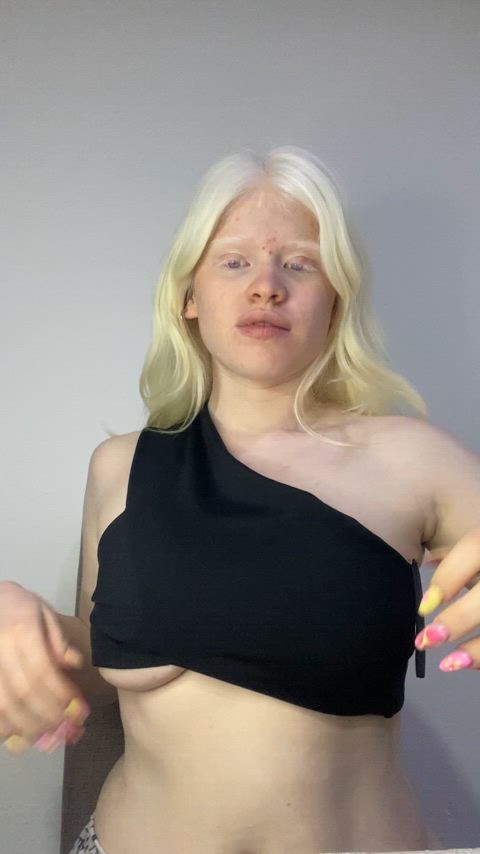 18yo and albino